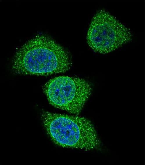 Polyclonal Rabbit anti-Human GIF / Intrinsic Factor Antibody (aa189-218, IHC, IF, WB)