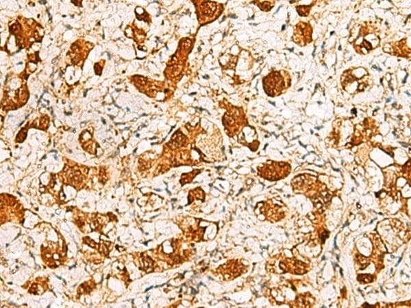 C11orf54 Antibody