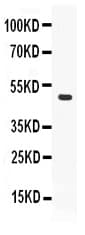 PLIN2 / ADFP / Adipophilin Antibody