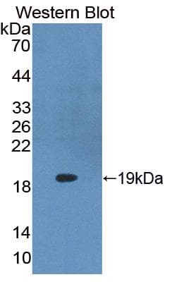 Delta-6 Desaturase / FADS2 Antibody (aa1-130, Biotin)