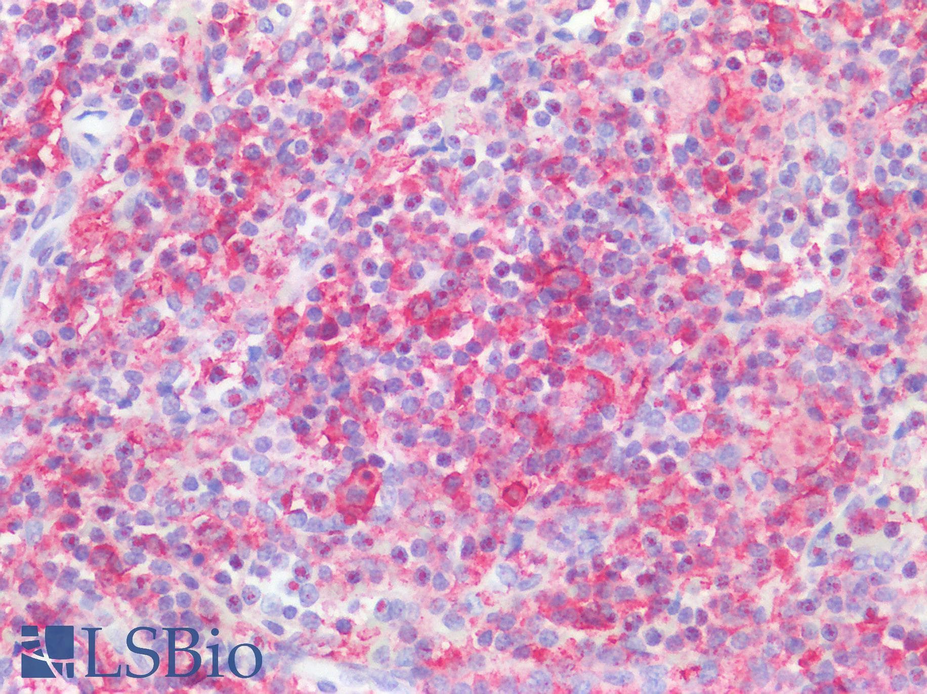 IHC-plus™ LILRB2 / ILT4 Antibody (clone 2G7E11)