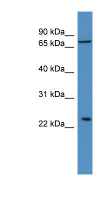 MOB3A / MOBKL2A Antibody (aa98-147)