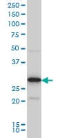 Monoclonal Mouse anti-Human EXOSC3 Antibody (clone 5C3, IHC, WB)