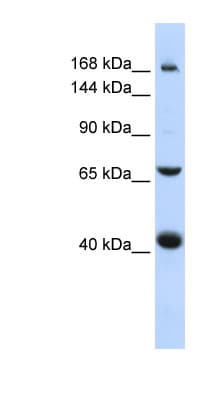Polyclonal Rabbit anti-Human SUR2 / ABCC9 Antibody (aa1440-1489, WB)