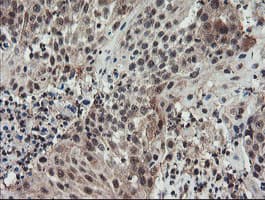 GCP60 / ACBD3 Antibody (clone OTI3A1)
