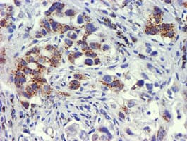 GOLM1 / GP73 / GOLPH2 Antibody (clone OTI5F4)