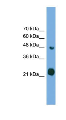 RAB37 Antibody (aa143-192)