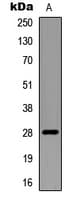 RNF138 Antibody (Internal)