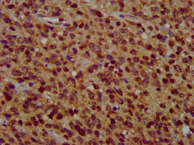 Polyclonal Rabbit anti-Human ZFX Antibody (IHC)