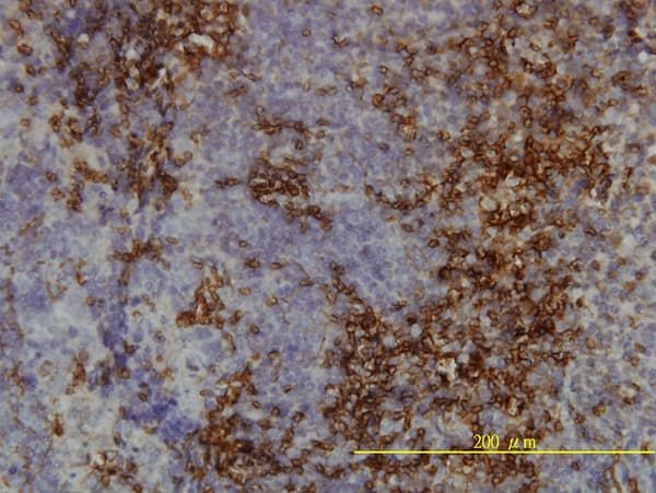 LY6H Antibody (clone 3E10)