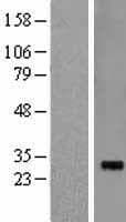 RCHY1 / PIRH2 Protein (Over-Expression Lysate Myc-DDK (Flag))