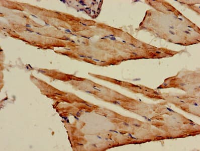 AK1 / Adenylate Kinase 1 Antibody (aa1-194)