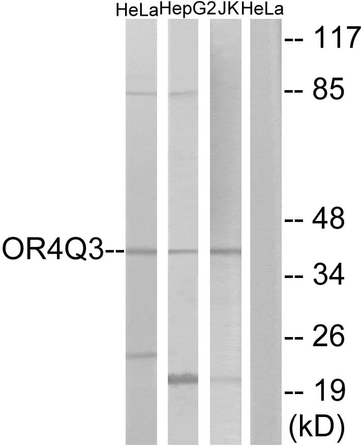 OR4Q3 Antibody (aa264-313)