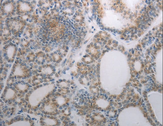 Polyclonal Rabbit anti-Human RBMS3 Antibody (IHC, WB)