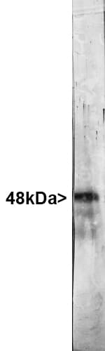 PathPlus™ Polyclonal Rabbit anti-Human RBFOX3 / NEUN Antibody (IHC, IF, WB)