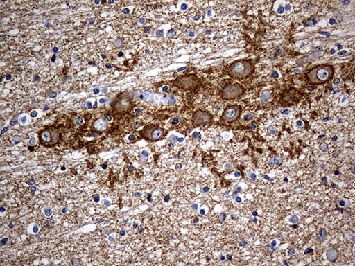 SEPT3 / Septin 3 Antibody (clone OTI3H6)
