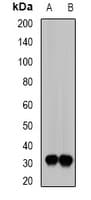 Polyclonal Rabbit anti-Human SIAH1 Antibody (IF, WB)