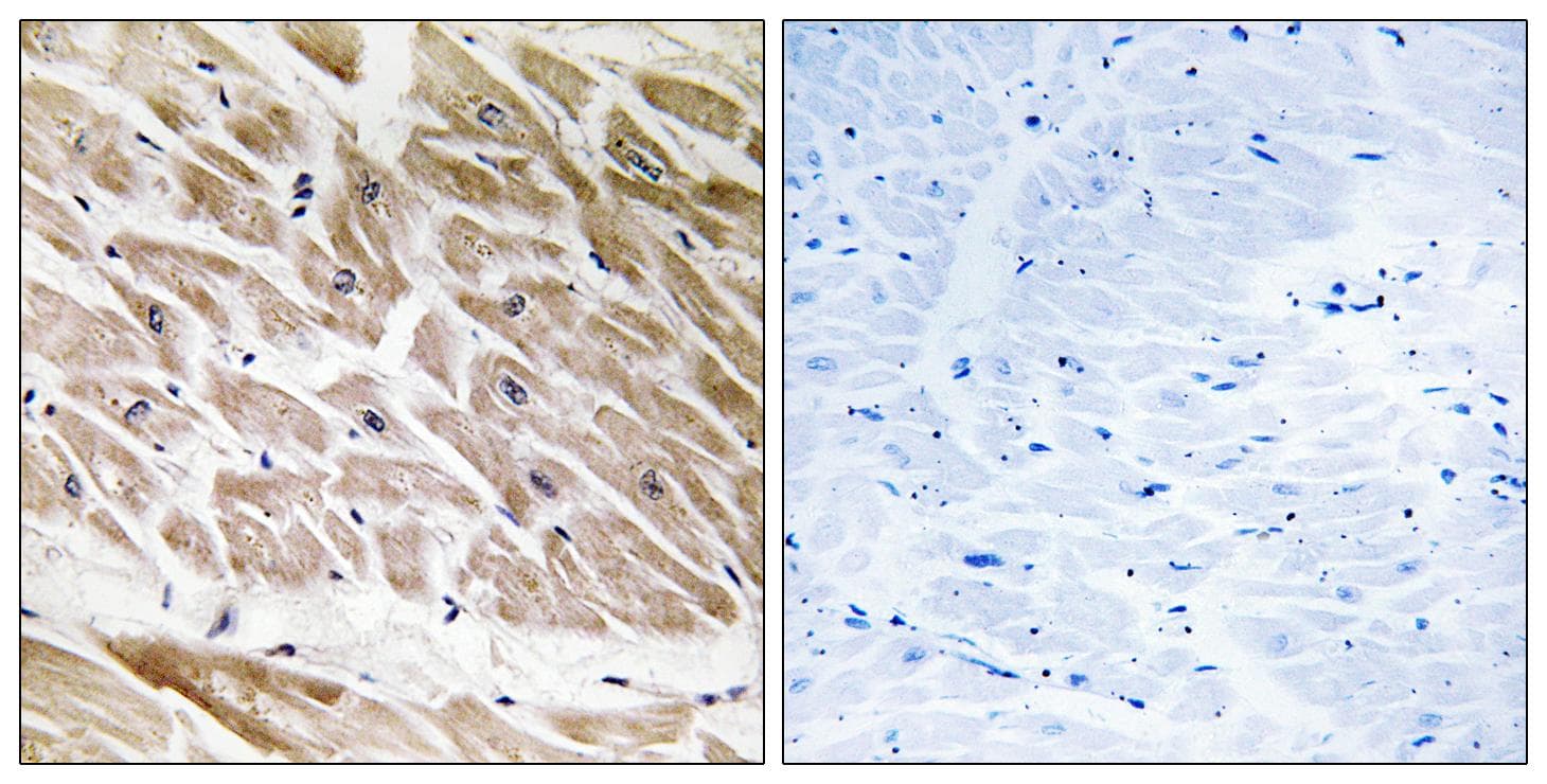 ARHGAP1 / CDC42GAP Antibody