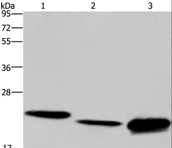 IHC-plus™ Polyclonal Rabbit anti-Human IL19 Antibody (aa39-52, IHC, WB)