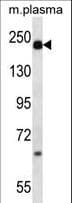 A2M / Alpha-2-Macroglobulin Antibody (aa93-120)