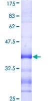 Human IDN3 / NIPBL Protein (Recombinant GST, N-terminus)