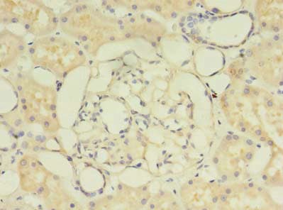 PIGO Antibody