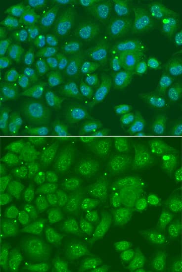 ANXA8L1 Antibody