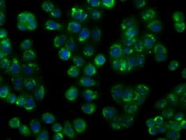 NIT1 Antibody (clone OTI4D12)