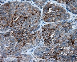 FAHD2A Antibody (clone OTI5G1)