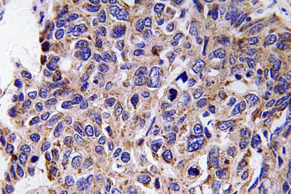 MMP12 Antibody (aa362-411)