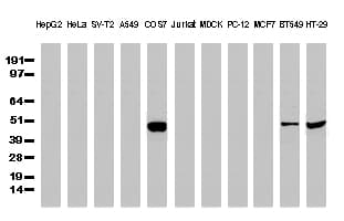 TP53 / p53 Antibody (clone UMAB62, Carrier-free)