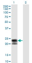 TNFRSF17 / BCMA Antibody (clone 1F10)
