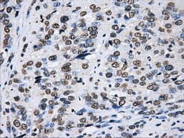 LOX / Lysyl Oxidase Antibody (clone OTI8G5)