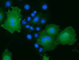 MOBKL2B / MOB3B Antibody (clone OTI1F9)