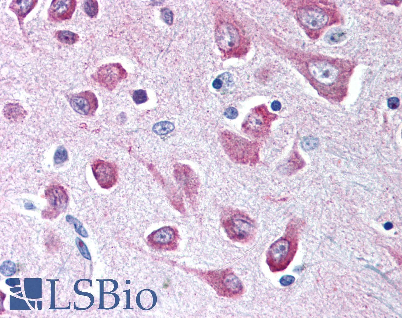 HTR3A / 5-HT3A Receptor Antibody (N-Terminus)