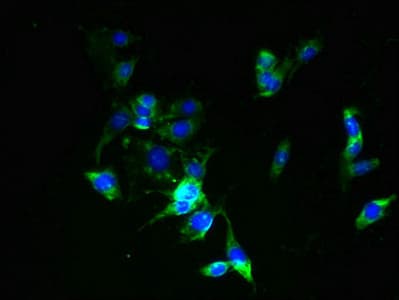ZDHHC6 Antibody