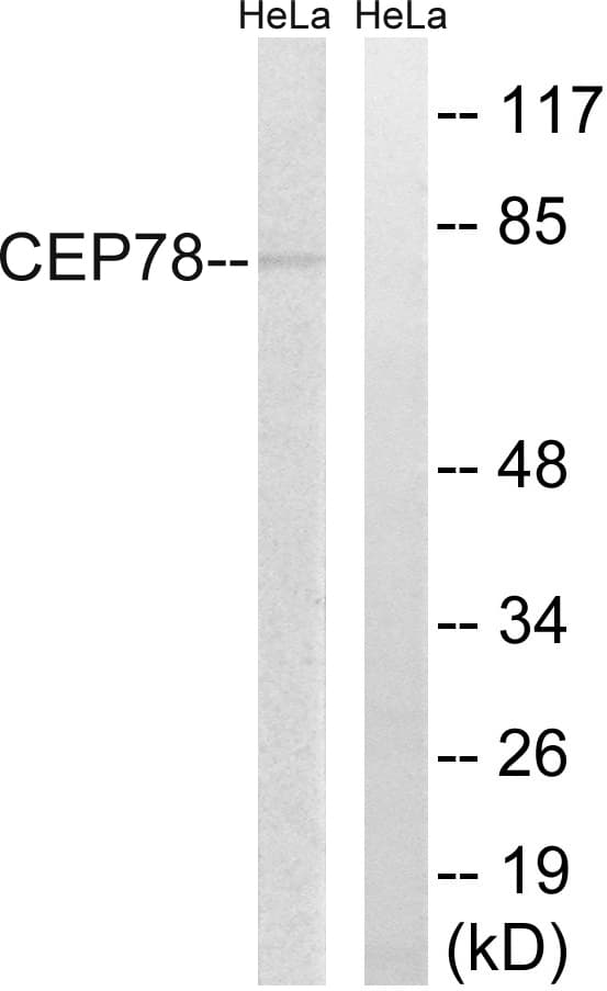 Polyclonal Rabbit anti-Human CEP78 / IP63 Antibody (aa301-350, IHC, WB)