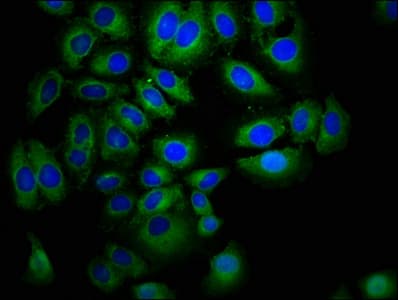 EPHA7 / EPH Receptor A7 Antibody