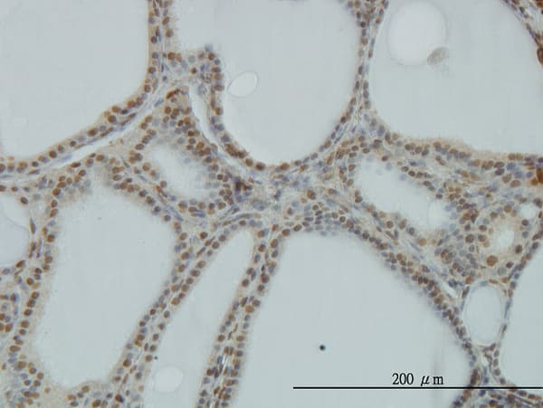 Monoclonal Mouse anti-Human POLR1C / RPA39 Antibody (clone 3A5-H2, IHC, IF, WB)
