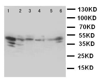 CCN4 / WISP1 Antibody (aa354-367)