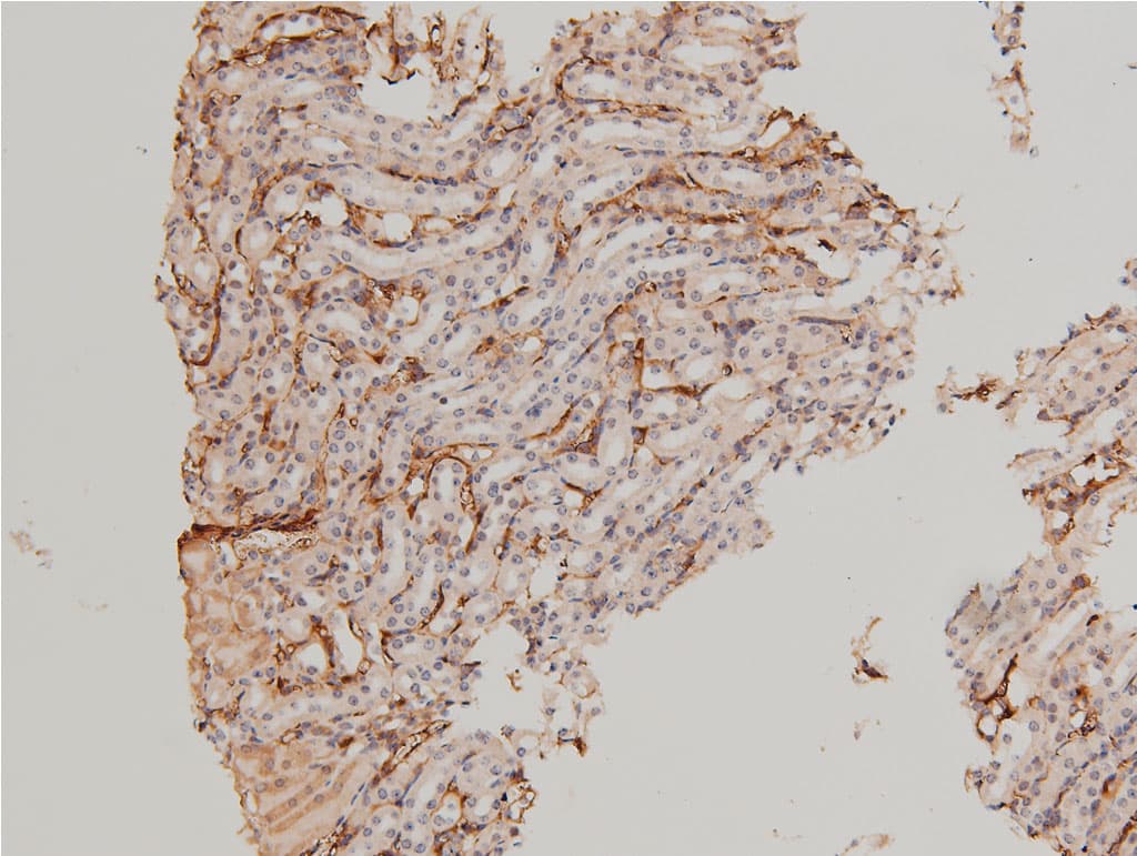 LIMK1 / LIMK Antibody (phospho-Thr508)