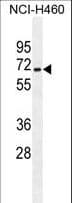 ZSCAN5B Antibody (aa403-431)