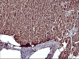 Monoclonal Mouse anti-Human MAP2K1 / MKK1 / MEK1 Antibody (clone OTI9E9, IHC, IF, WB)