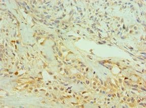 NTRK2 / TRKB Antibody (aa32-282)