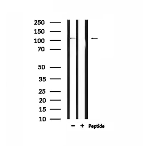 IFIH1 / MDA5 Antibody