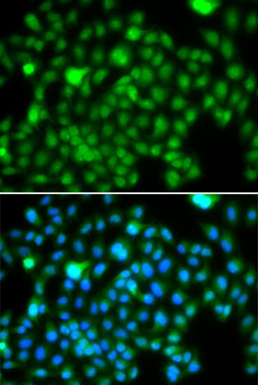 Polyclonal Rabbit anti-Human N6AMT1 Antibody (IHC, IF, WB)