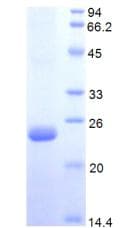 Human PROS1 / Protein S (Recombinant His)