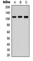 IHC-plus™ ASAP2 / DDEF2 Antibody (Internal)