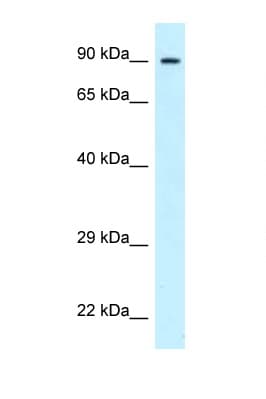 Polyclonal Rabbit anti-Human PFKP Antibody (aa695-744, WB)