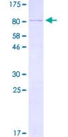 Human KRT3 / CK3 / Cytokeratin 3 Protein (Recombinant GST)